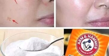 4 Ways to Erase Age Spots with Baking Soda for Younger, More Even Skin